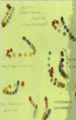 рис.8: схема инфантильного сколиоза